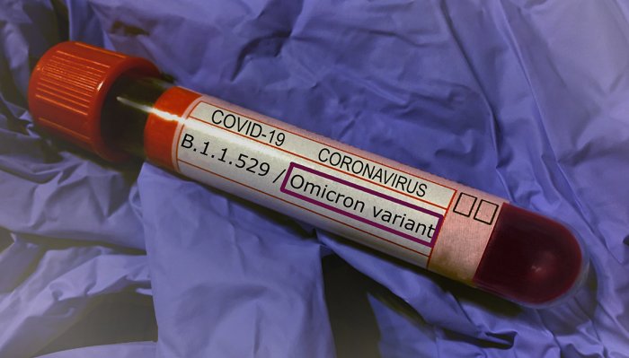 image Séquençage : Variant Omicron ou pas : le verdict se fait encore attendre