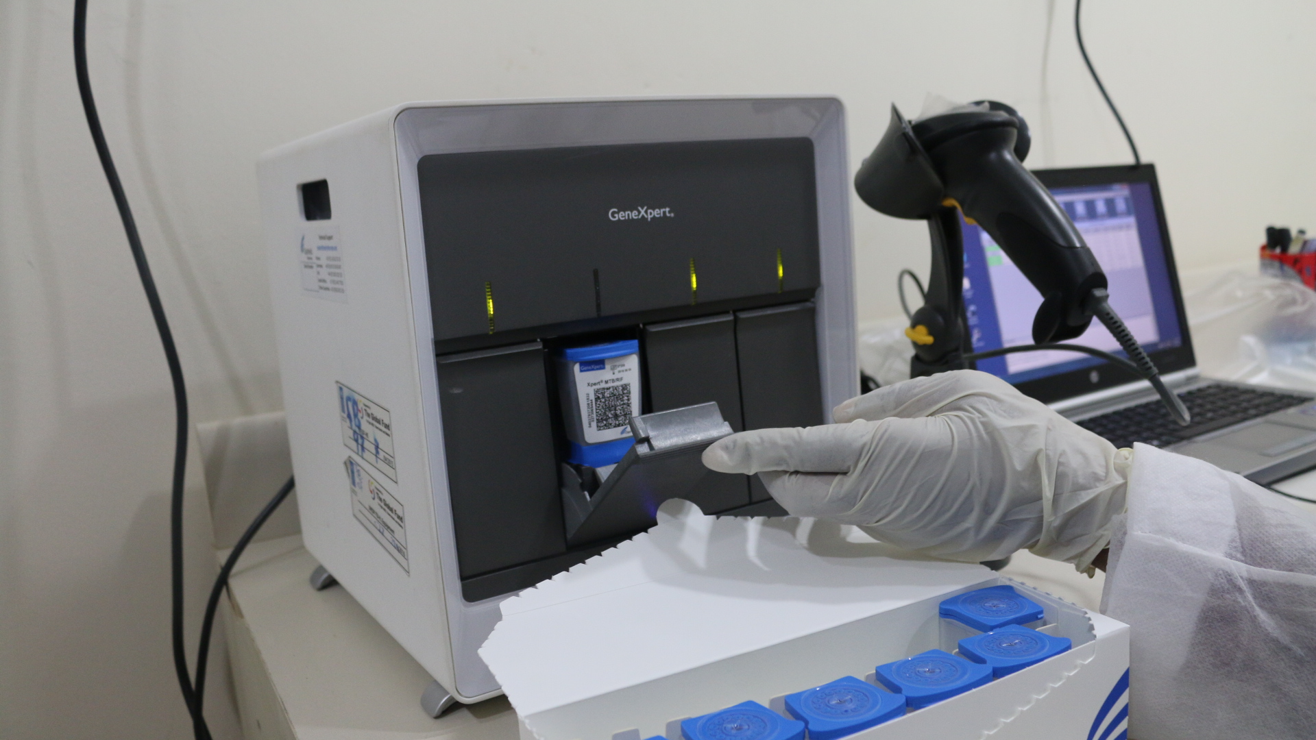 image A-t-on besoin de poste de sécurité microbiologique pour manipuler le GeneXpert ?